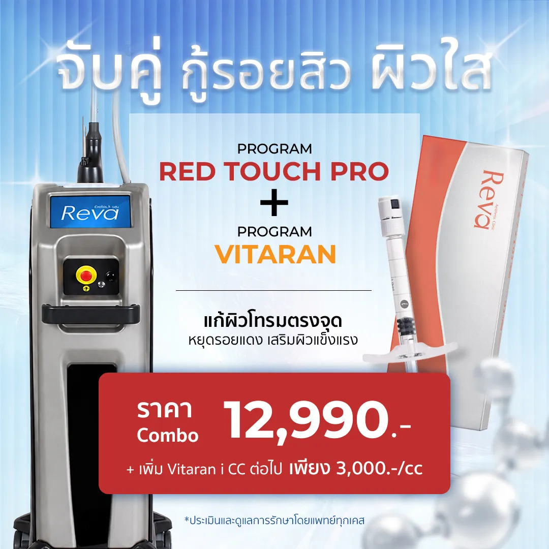 red touch x vitaran